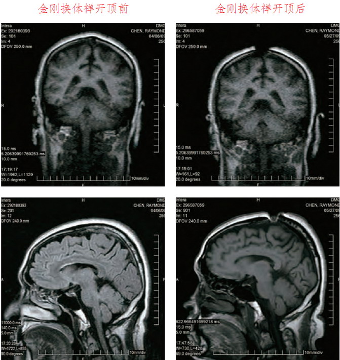 祿東贊法王修金剛換體禪令神識出體取物-图片3