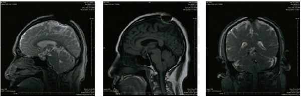 開初仁波且修攤屍拙火定 溫度高達攝氏92度-图片4