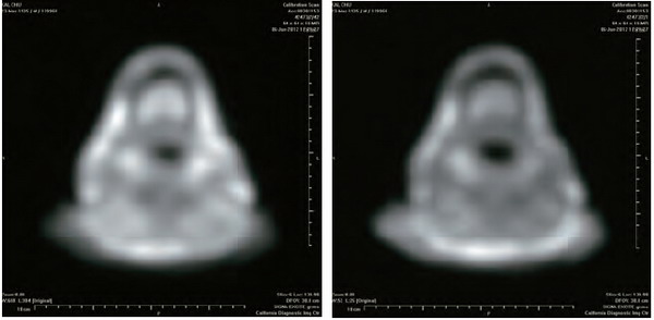 開初仁波且修攤屍拙火定 溫度高達攝氏92度-图片5