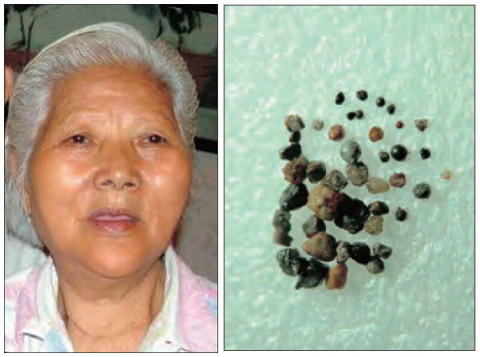 第三世多杰羌佛座下大量弟子脫離輪迴生死,成就解脫部份實例-图片7